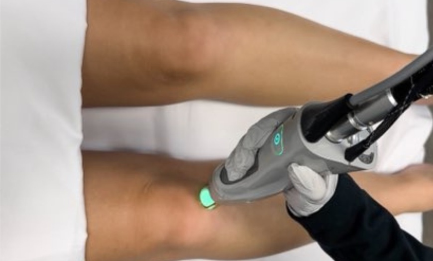 Image 1: Laser Hair-Removal Sessions on a Small, Medium or Large Area.