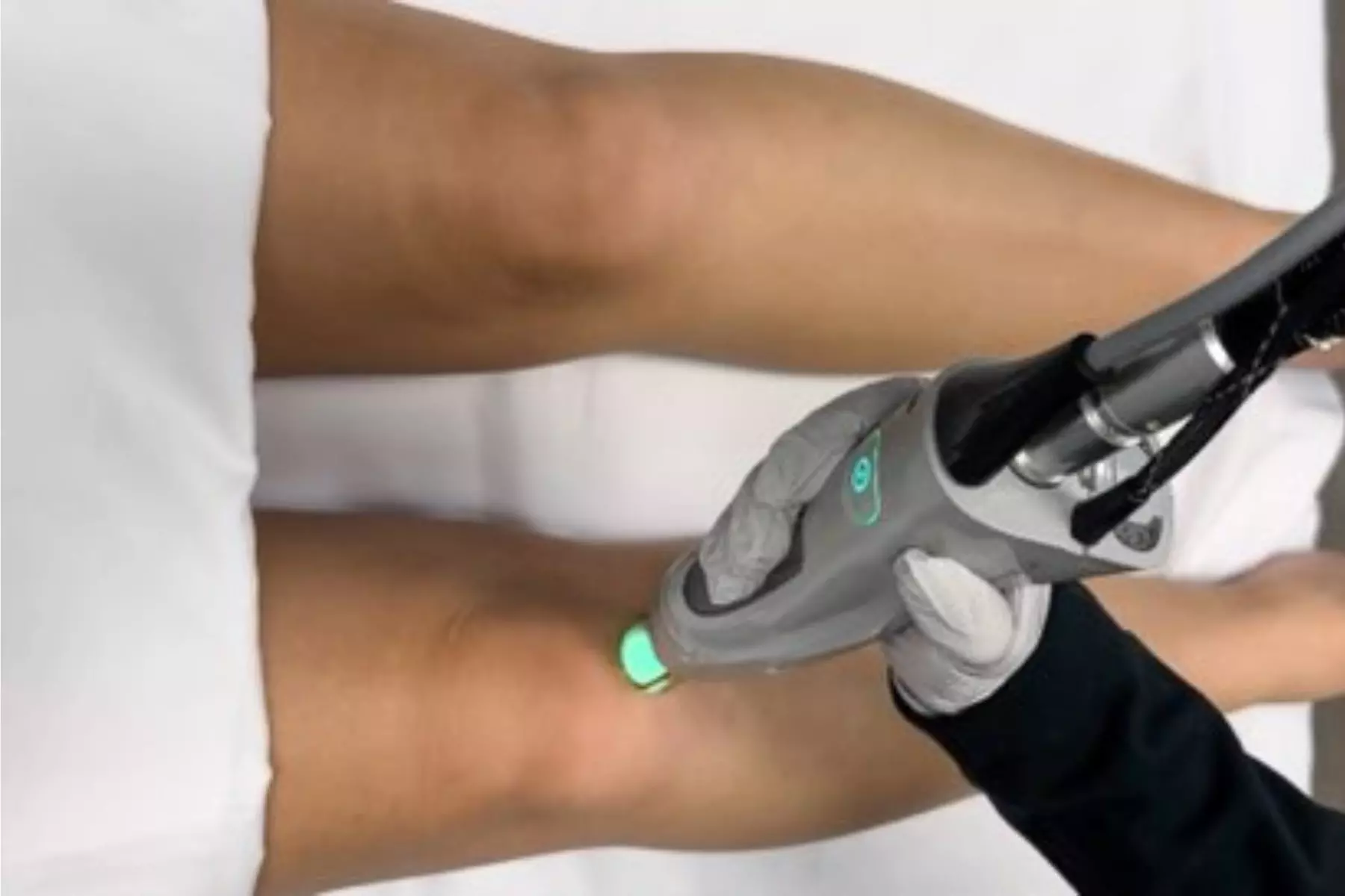 Laser Hair-Removal Sessions on a Small, Medium or Large Area.