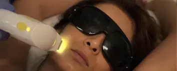 One or Three IPL Photofacials at Ziba's Spa (Up to 62% Off) - Second Medium