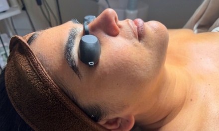 One Signautre Glow Chemical Peel (60 minutes) - SKIN THERAPY by kiah