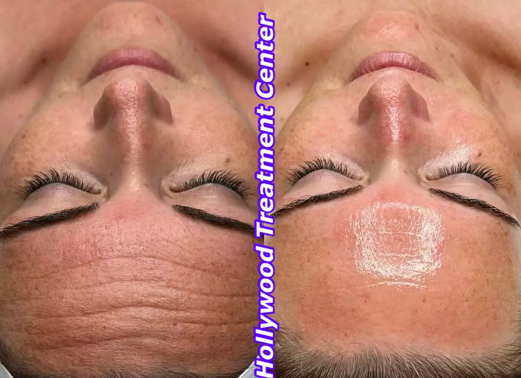 Révélez votre éclat : soins visage et modelages