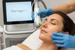 Transform with SOS Medical's 1 or 3 New Thermage Oligio: Face Only or w/ Neck|Age 35-65 (120 min)(Up to 50% Off) - Second Medium