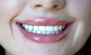 Wybielanie zębów z lampą LED lub Beyond: 2 rodzaje pakietów do wyboru