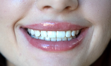 Wybielanie zębów z lampą LED lub Beyond: 2 rodzaje pakietów do wyboru