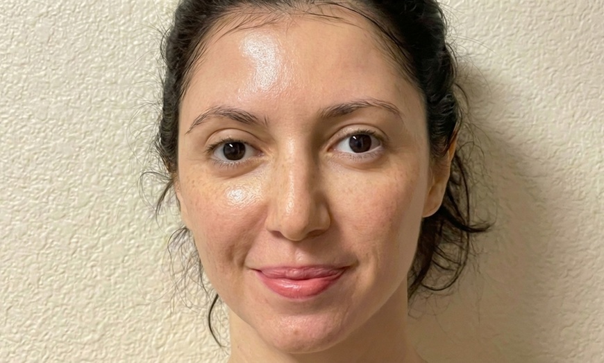 Image 5: 5th Gen Thermage FLX Skin Tightening & Lifting for Face, Neck & Body