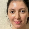 Image 5: 5th Gen Thermage FLX Skin Tightening & Lifting for Face, Neck & Body