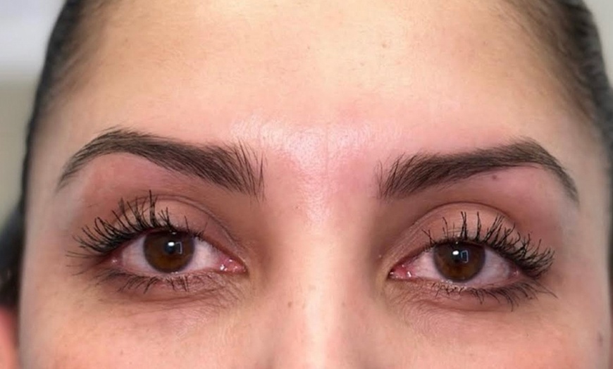Image 1: Up to 30% Off on Injection - Botox at Metamorph Med Spa