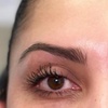 Image 1: Up to 37% Off on Injection - Botox at Metamorph Med Spa