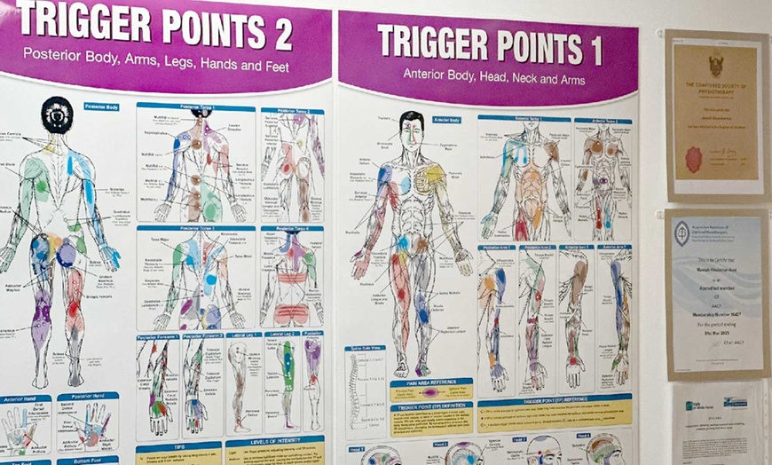 Image 8: 1, 2 or 3 Advanced Acupuncture Sessions with Cupping
