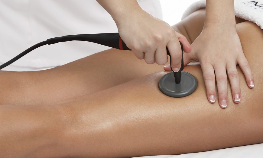 Image 15: 1 o 3 sesiones de tratamiento facial con vitaminas o masaje