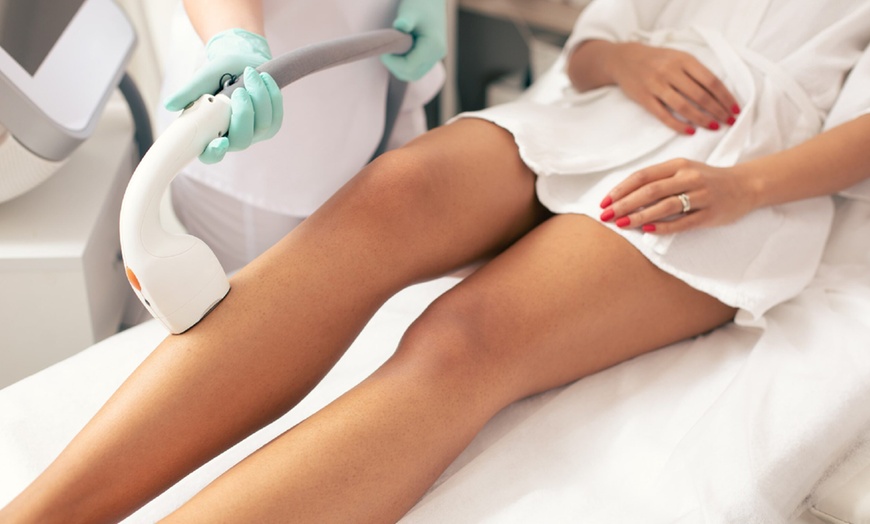 Image 1: Get Smooth Skin with Six Laser Sessions