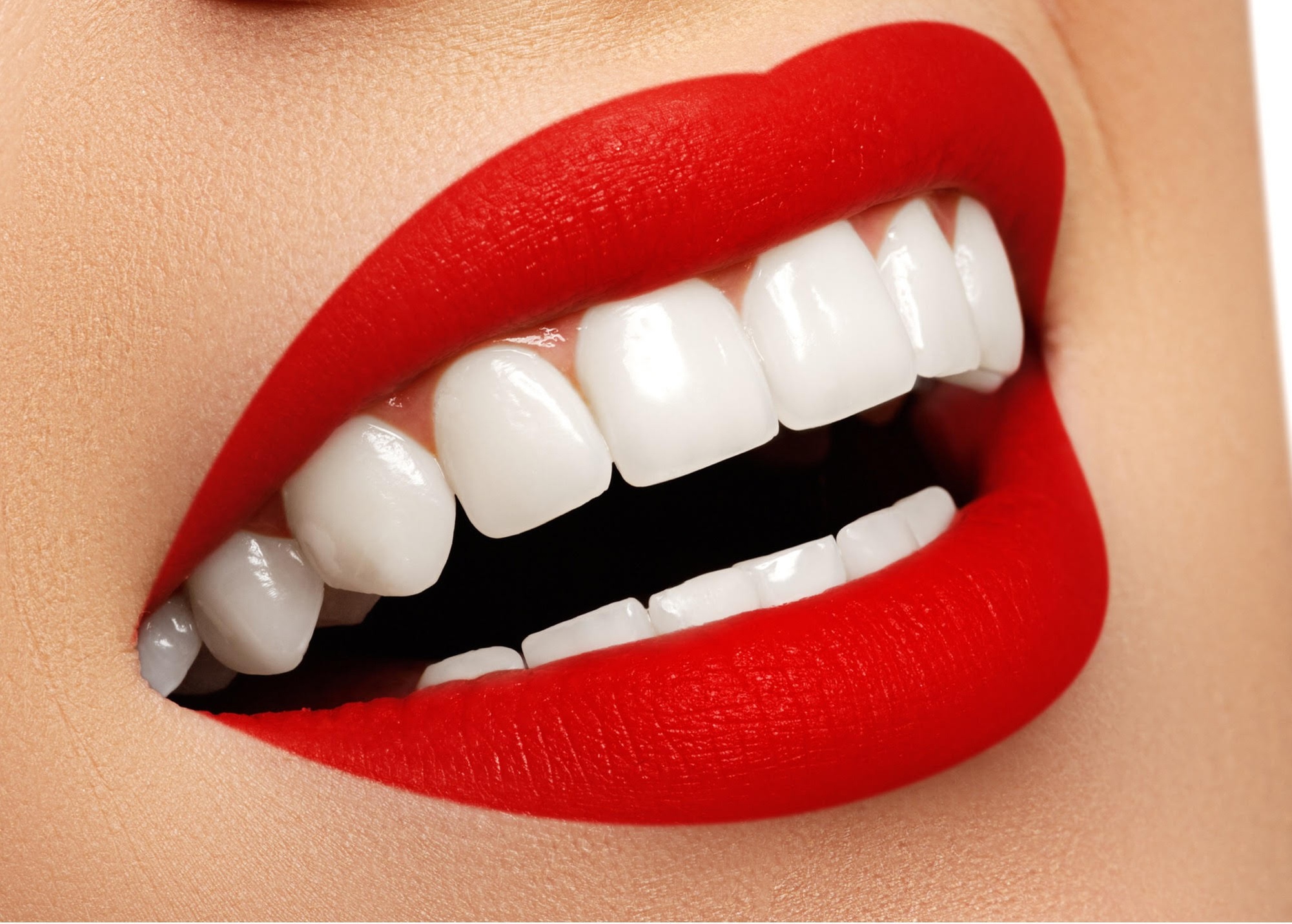 Quick Teeth Whitening: One or Three 20-Minute Sessions