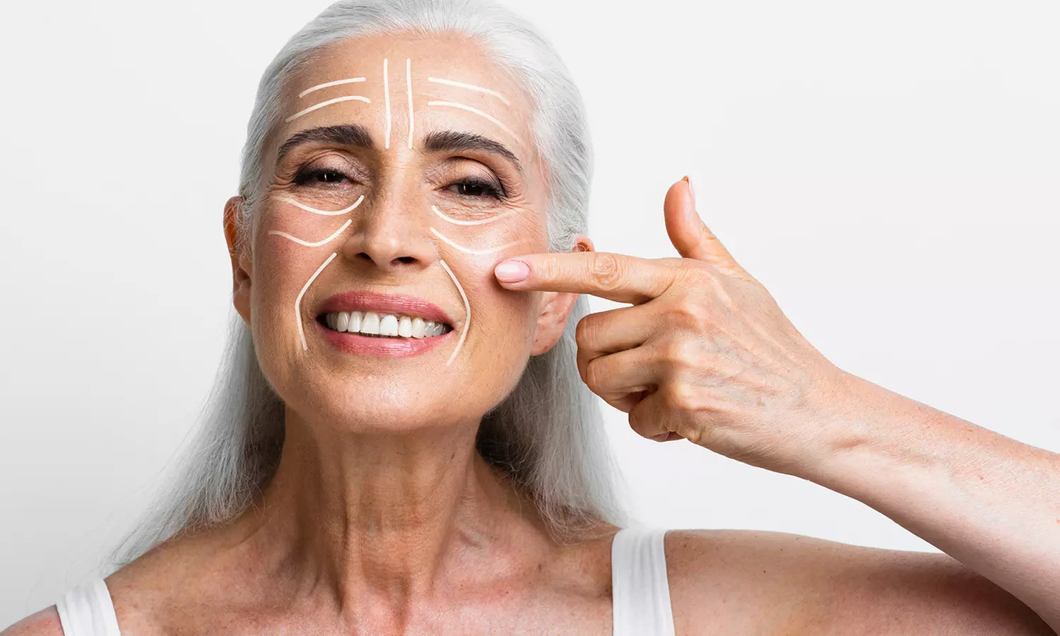 Non-Surgical Protein Face Lift at Miami Kiss