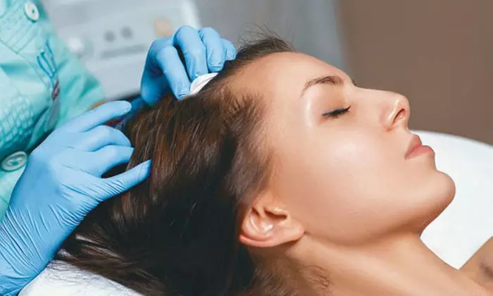 Bioestimulación capilar con opción a vitaminas para tratar la alopecia