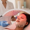 Image 1: Enjoy Skin Needling With LED Therapy, Face Mask, And Consultation