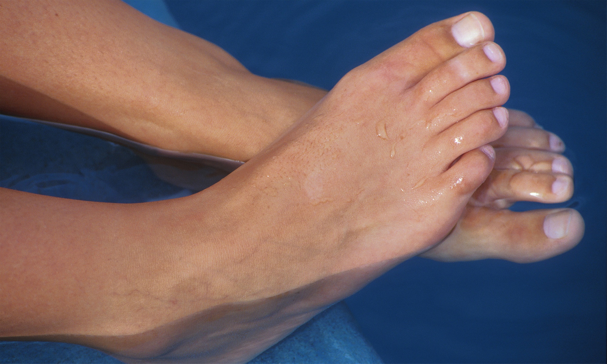 Relax with 4 Sessions Foot Detox and Foot Detox Services