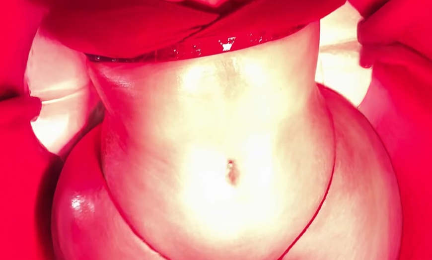 Image 3: 60 Minute Lymphatic Drainage Massage: 1 or 3 Sessions