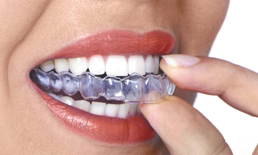 Image 2: Cosmetic Dentistry Consultation