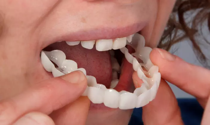 $29 for Cosmetic Dentistry Consultation at Advanced Dental Services, Four Locations - Primary Image