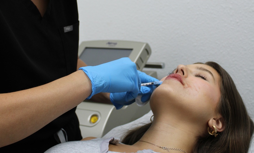Image 2: 39% Off Smooth Lines with Juvederm Ultra XC