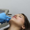 Image 2: 39% Off Smooth Lines with Juvederm Ultra XC