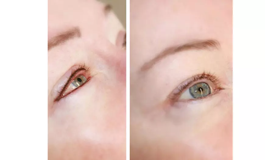 Image 4: Enhance Your Look with HIFU for Neck/Face or Both or Tattoo Eyeliner