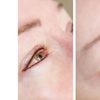 Image 4: Enhance Your Look with HIFU for Neck/Face or Both or Tattoo Eyeliner