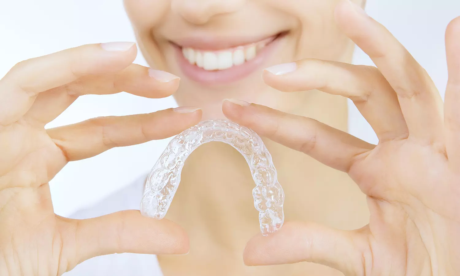 Up to 62% Off at Clear retainers and/ bleaching trays - Primary Image