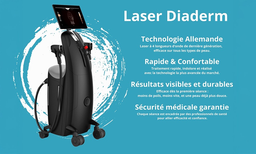 Image 2: Épilation laser durable sur petites, moyennes et grandes zones