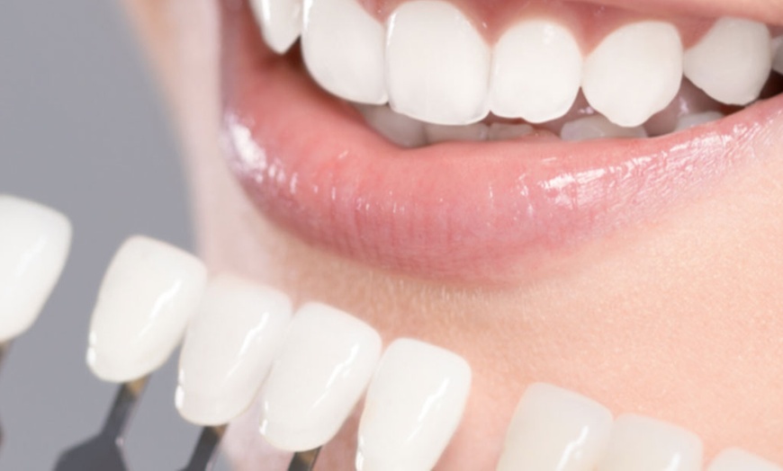 Image 6: Checkup, Scale, and Polish or Teeth Whitening with In-Home Trays