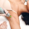 Image 6: Six Laser Hair Removal Sessions on One, Small, Medium or Large Areas