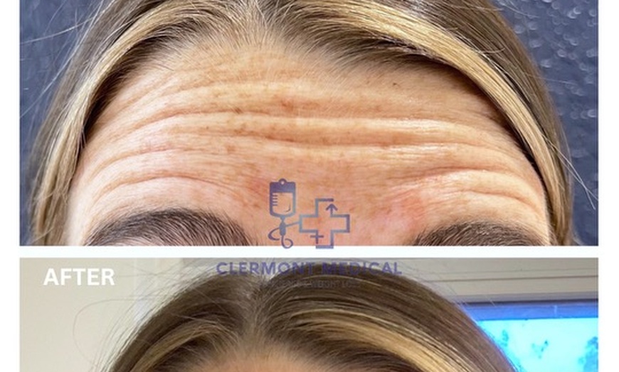 Image 4: Unveil a New You: Special Pricing on Botox and Juvederm!