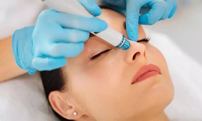 Rejuvenate w/ One or Three Microneedling and Hyaluronic Acid Sessions (Up to 37% Off) - Primary Image