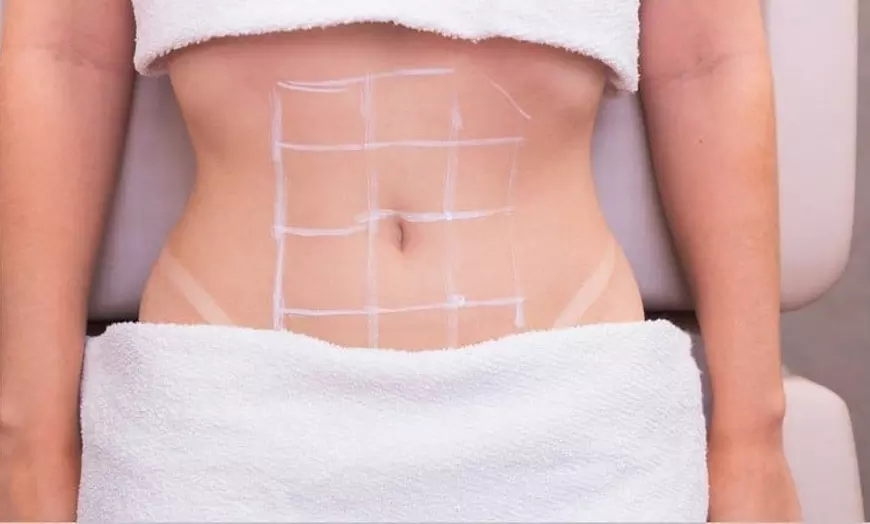 Image 9: 1, 3 o 6 sesiones de carboxiterapia facial o corporal con presoterapia
