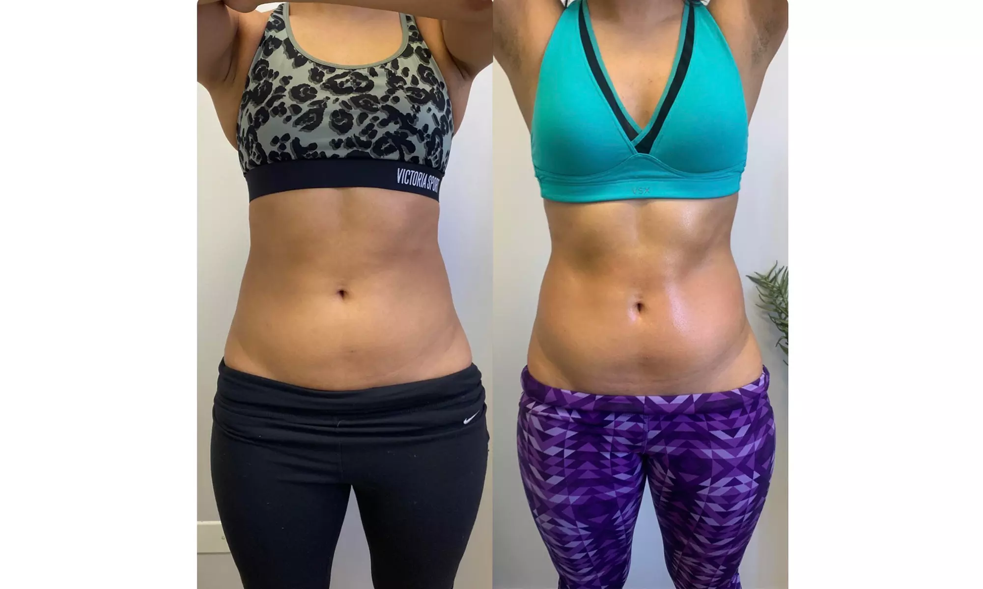 Sculpt & Tone Your Body With Muscle Sculpt At Pure Sculpt Body & Skin