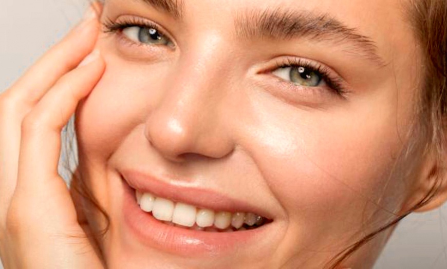 Image 3: Limpieza facial con tratamiento antiarrugas, hydralips, relleno y más