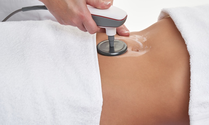 Image 4: 1, 2 o 4 sesiones de radiofrecuencia facial o corporal con masaje