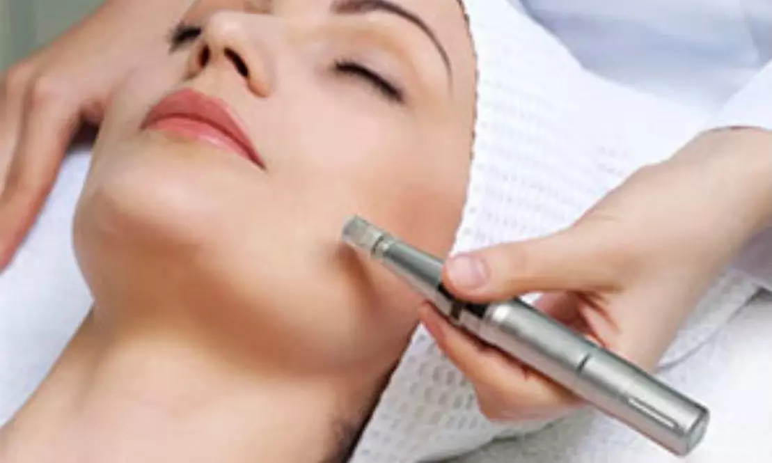 Up to 60% Off on Micro-Needling at Greater Lansing Aesthetic Medicine - Second Medium