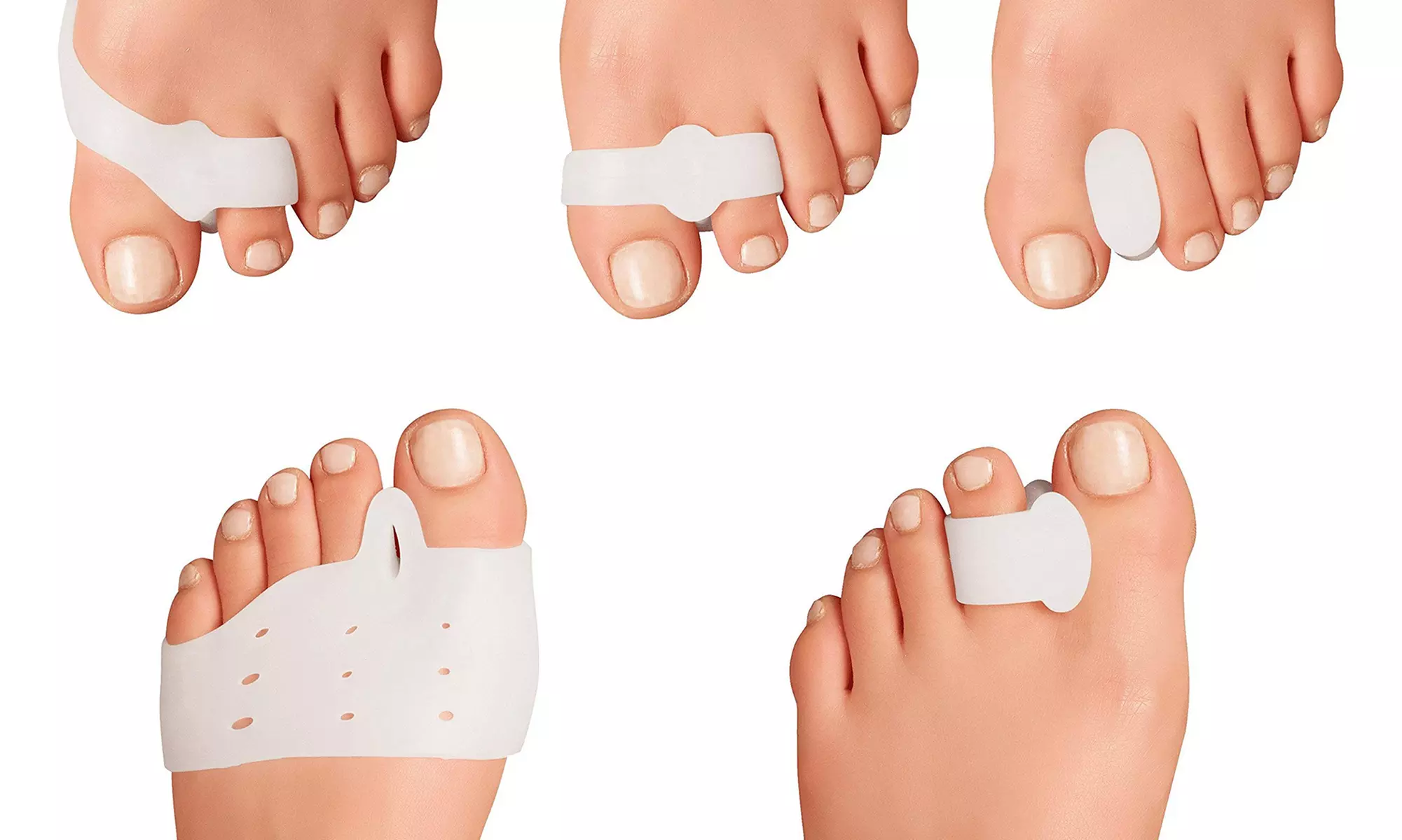 10-delige gezondheidskit voor tenen 'Bunion Buddy'