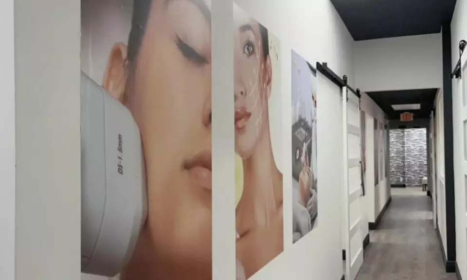Lip Sculpting with Hyaluronic Acid Injection