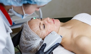 Up to 40% Off on Ultherapy / Ultrasonic Facial at Glam-Amor Skin LLC