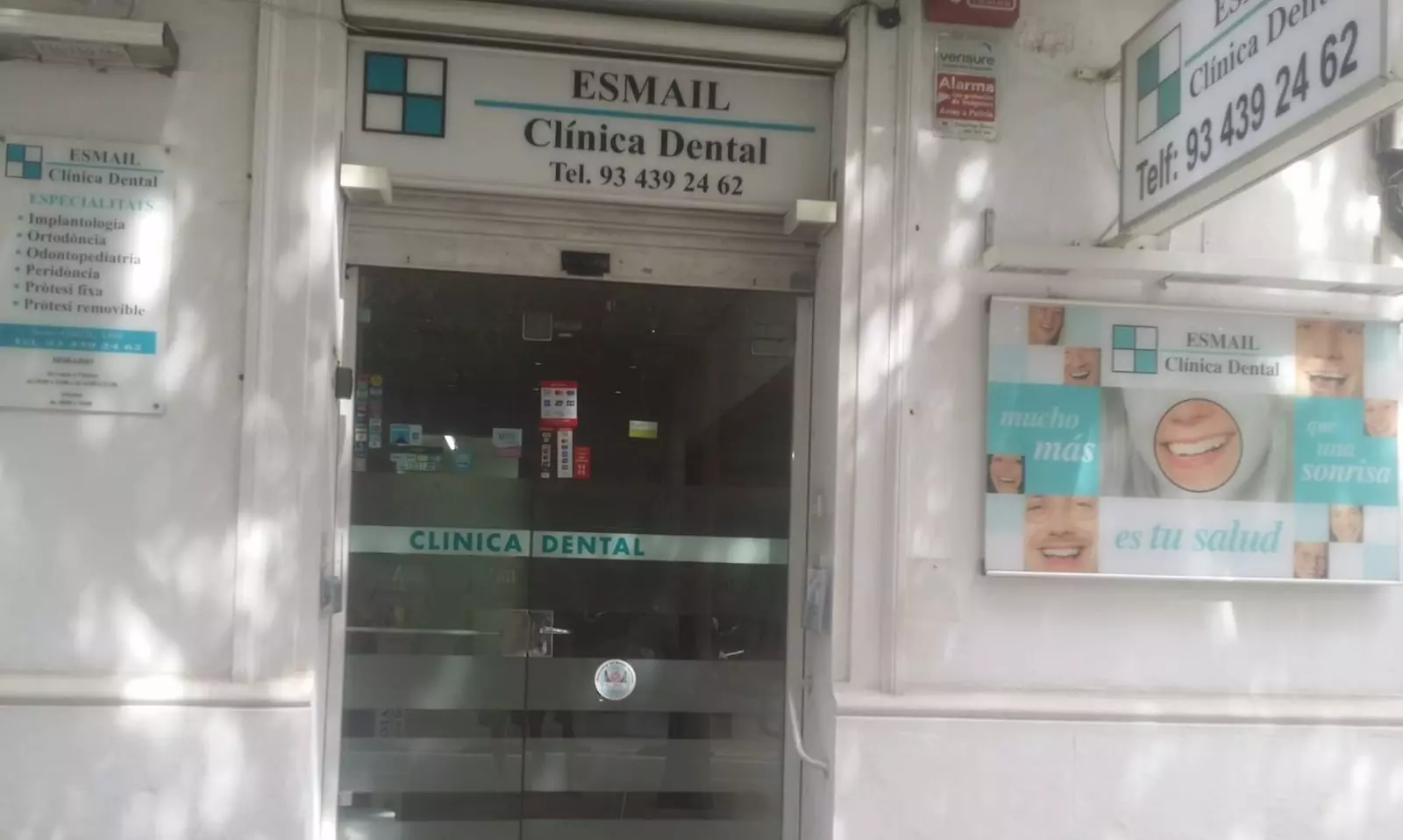 Férula de descarga rígida en Clínica Dental Esmail