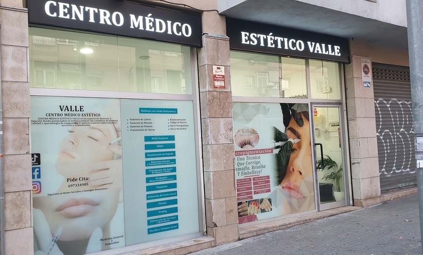 Image 3: Sesión de manicura con esmaltado en Centro Médico Estético Valle