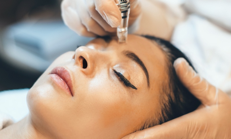 Up to 60% Off on Micro-Needling at Bonafide Dreams