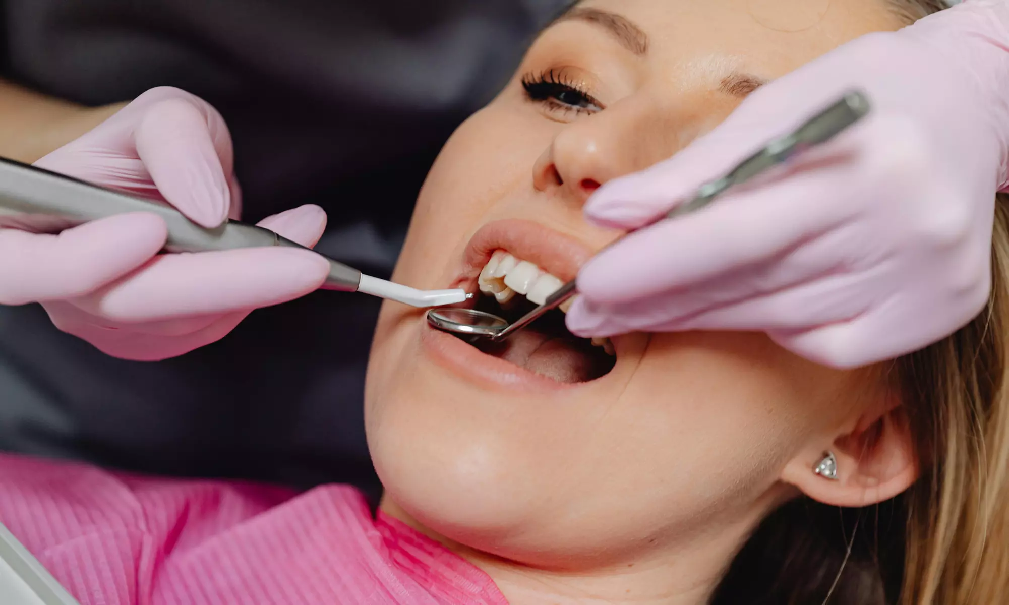 ¡Sonríe sin preocupaciones! ¡Tu sonrisa perfecta te espera!