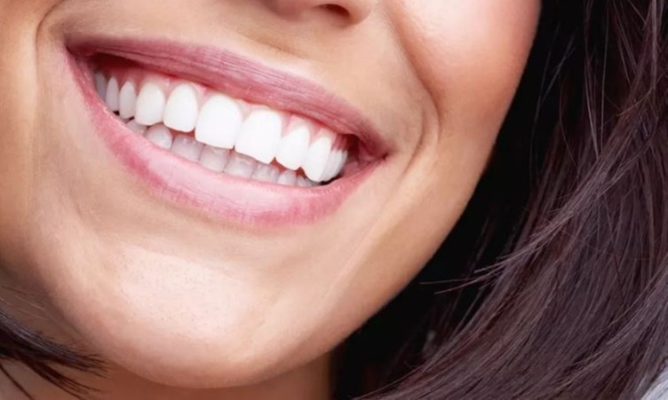 Up to 62% Off on Teeth Whitening - In-Office - Non-Branded at Tempe Laser Center