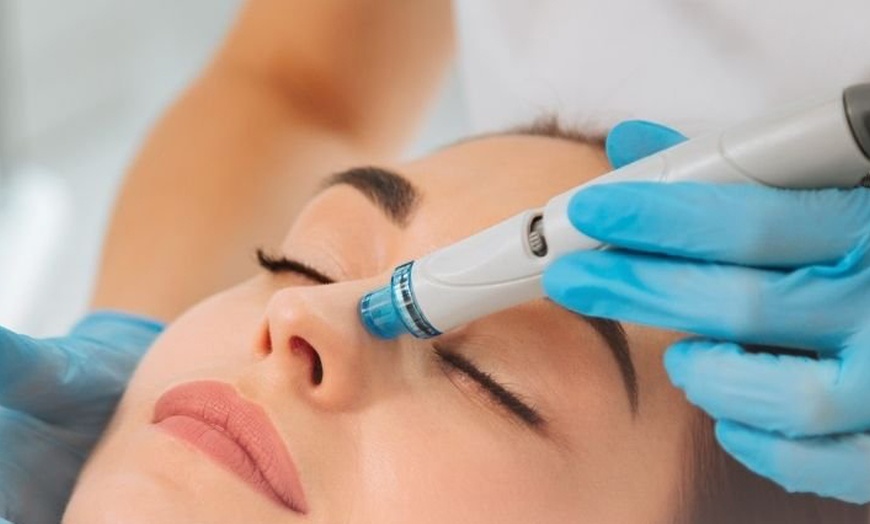 Image 1: Expertise in huidverzorging: hydrafacial behandeling in Amsterdam