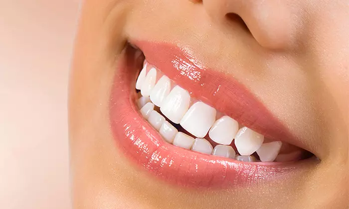 Revisión con diagnóstico, limpieza dental con ultrasonidos, pulido y fluorización por 12,90 € en Ayala - Primary Image