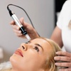 Image 1: 1 or 3 Sessions of Micro-Needling with Serum at Chelsea Beauty