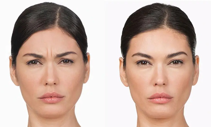 Image 3: Expert Injectables to Smooth Wrinkles & Enhance Beauty